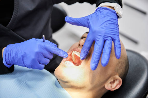 Best Emergency Dental Care for Broken or Chipped Teeth in Pecan Plantation, TX